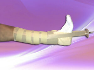 Tracción de Pierna Tipo Bota Universal 14