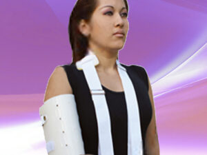 Aparato Sarmiento para Fractura de Humero